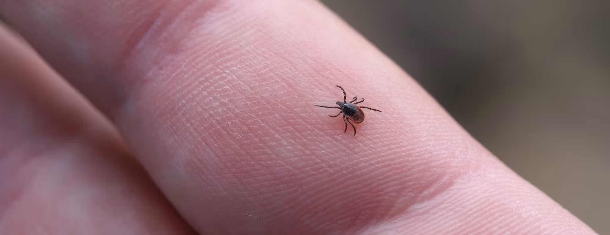 female blacklegged tick on a person's hand